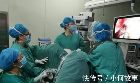 肛门|医生总结三种最疼的手术,第一个比生孩子还疼,你绝对不想经历