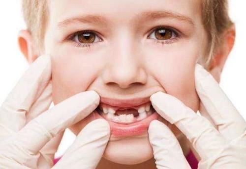 孩子|宝宝不吃糖坚持刷牙,却还是长龋齿,家长可能忽略了这4点