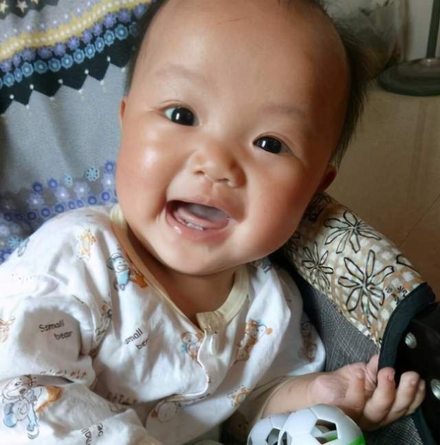 医生|宝宝一出生就有两颗牙齿,宝妈满心欢喜,医生却泼冷水:拔掉吧