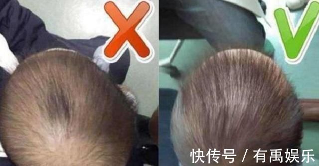 扁平|半岁儿子睡成“砖块头”,宝妈想出奇招方法补救,获得医生称赞