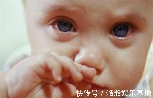 小宝宝|格格宝宝脸上有这3种“特征”,暗示可能脾胃不好,家长多留意
