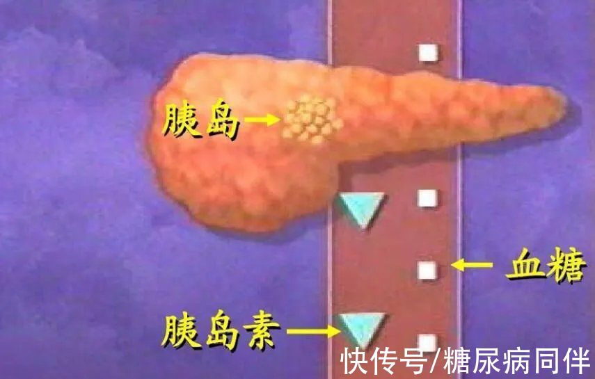 照护|逆转糖尿病，做到这件事有希望