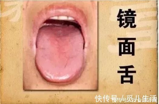 夏天|二陈丸一个能让身体“脱胎换骨”的千年古方,这个夏天很需要