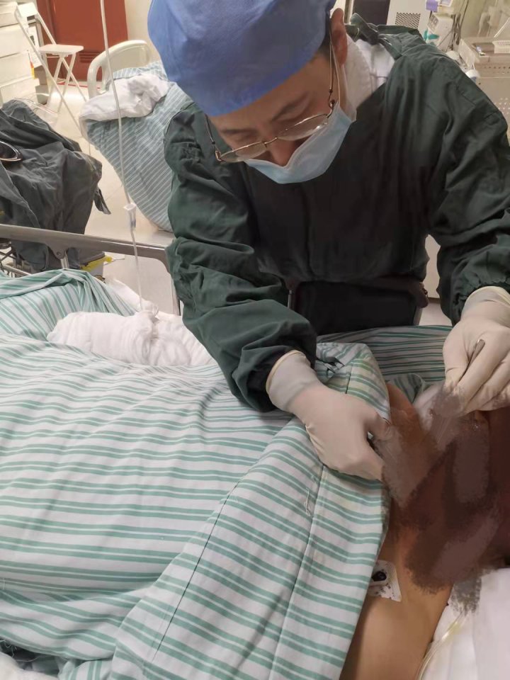 西溪湿地卡式炉喷火烫人事故 住院患者病情稳定