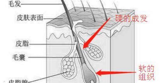 缺什么|缺什么维生素会长白发导致白发的原因有哪些专家来告诉您
