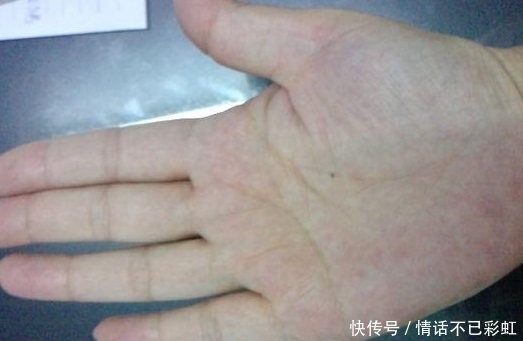 富贵|女人的富贵痣，就是天生的富贵命，一生福禄双全富贵无比锦衣玉食