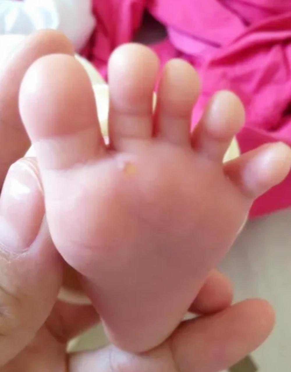 脚部|孩子再喜欢这种鞋,妈妈也要尽量避免购买,潜藏的危害很大