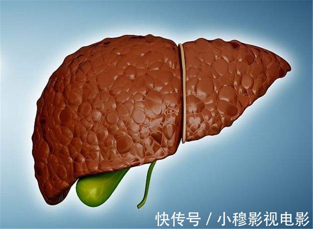 肝癌|母女二人频繁腹泻,双双查出肝癌?医生叹息:这种“汤”建议少喝