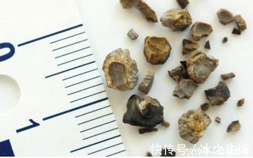 毫米汞柱|高血压不要担心，日常的1种食材，喝水时撒点，血压健康又稳定