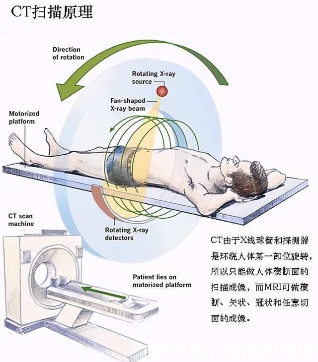 声波|做B超前涂的那层黏黏的、凉凉的液体是什么？做完要马上洗掉吗？