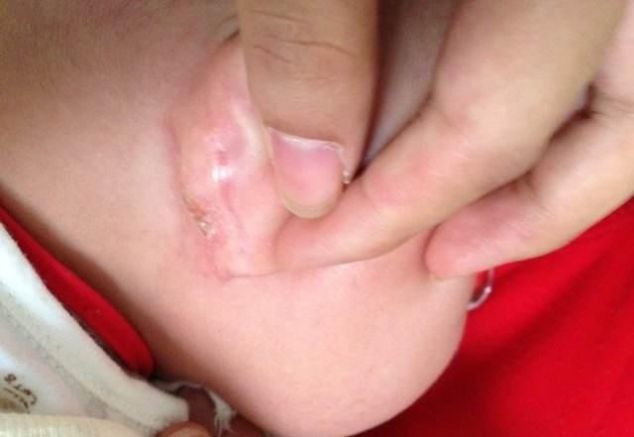 耳朵|孩子耳朵旁边长出“聪明孔”,奶奶好奇挤了一下,不料却惹了麻烦