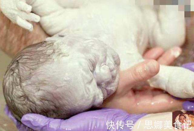 小雪人|妻子生下“小雪人”宝宝,陪产丈夫看到后连忙解释:和我没关系