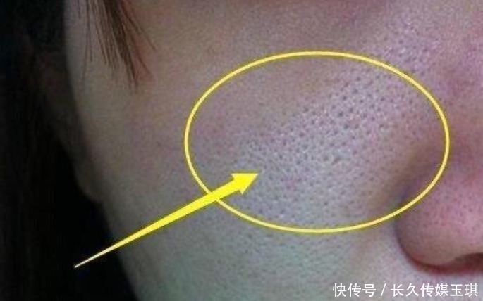 皮肤|平时再这样护肤,皮肤会越来越差,毛孔变粗大,不想烂脸赶紧改!