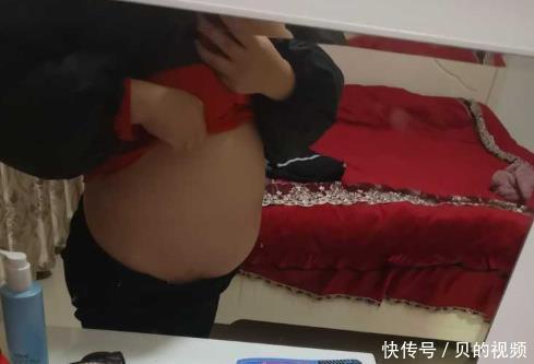 胎儿|孕中期产检被这诊断停育,医生怒斥不想要就别生