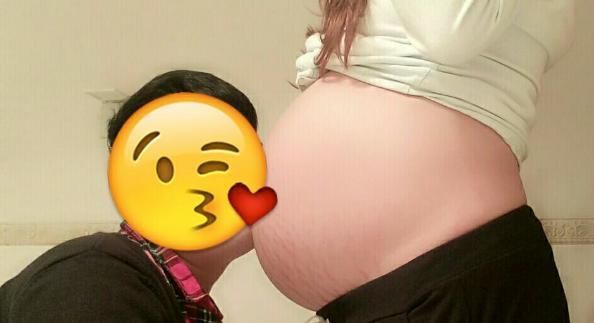 后遗症|剖腹产真的好?产科医生透露:起初是好,后遗症生二胎时才会暴露