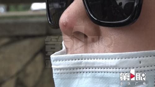 美女想要变得更美 整形后非常后悔