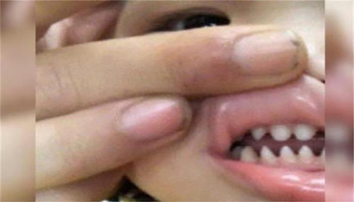 儿子|儿子长了一口“鲨鱼牙”，妈妈连忙送医，医生无知害了孩子
