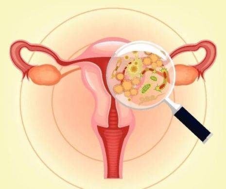 分泌物|29岁女子,查出宫颈癌晚期,家属病床前痛哭,无奈放弃治疗!