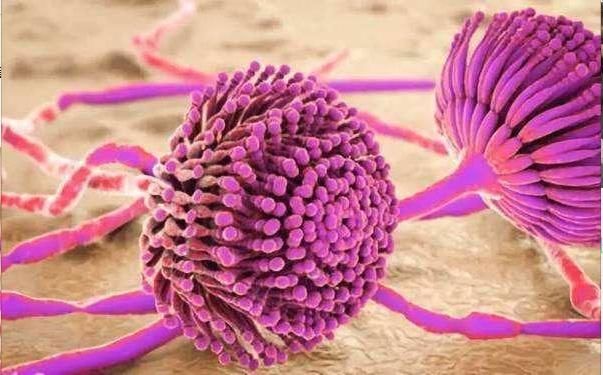 医生|54岁女子,肝癌晚期,化疗2次离世,医生怒斥:冰箱1物伤肝又索命