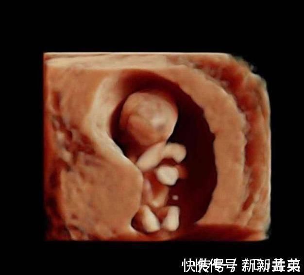 羊水|胎儿从卵泡到性别形成,17张图片清晰诠释,男宝女宝看得很清楚