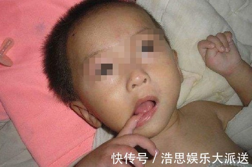 张女士|8个月宝宝检查患上脑瘫，只因妈妈在枕头下放了它，家长们当心