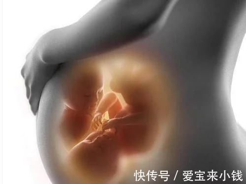 广州坤和助孕靠谱吗（试管婴儿：为什么不提倡多胎移植？）