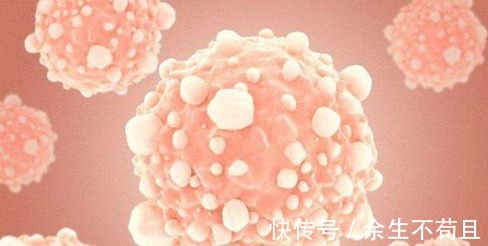 癌症|若是诊断出癌症早期,营养专家常吃3样东西,癌细胞渐渐远离你!