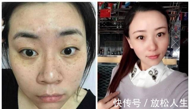 老年斑|药店有种“不起眼”的祛斑霜,雀斑老年斑都清除,美白祛斑还嫩肤!