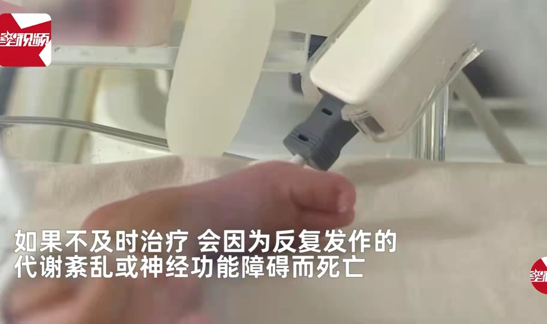 香妃同款？新生儿得罕见病全身散发一股甜香，洗都洗不掉！