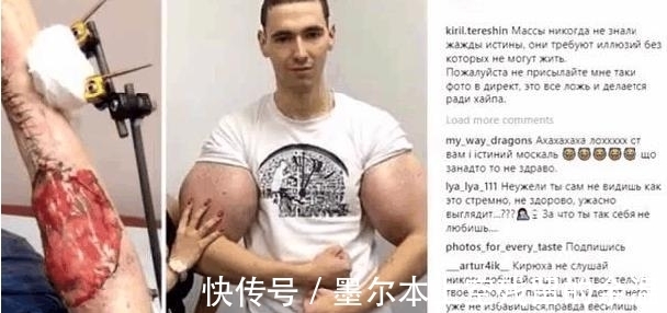 男子|男子在健身房健身时,因为用力过猛感觉不对,抬头观察,手臂爆啦