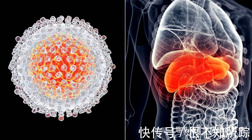 肝硬化|肝病专家建议，不想肝炎、肝硬化盯上你，晚餐不要超过1个点