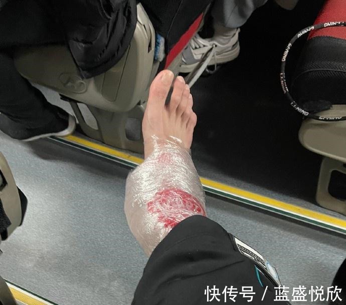 出勤率|郭艾伦提前离队!再歇2场真不要MVP了,遭胡明轩垫脚后遗症太大了!