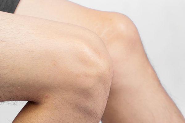 更年期|雌激素趋近“干涸”的女性，身体可能会有四个特征