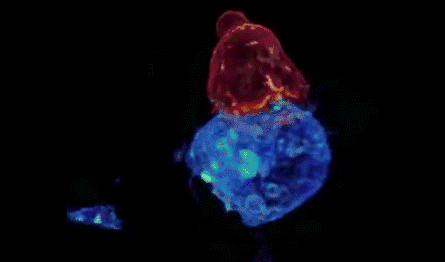 人类|两个月治好癌症，120万的CAR-T会成为人类终结癌症的绝招么？