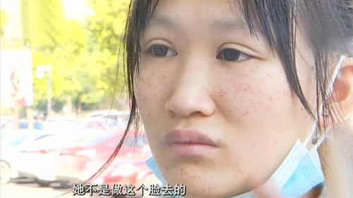 理发店|脸跟马蜂窝一样!女孩花19.9元理发却反背一万多贷款,还差点毁容