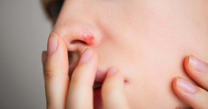 宫寒痛经|天气一凉,手脚冰凉,“4个原因、2个建议”,改善冰凉,温暖全身