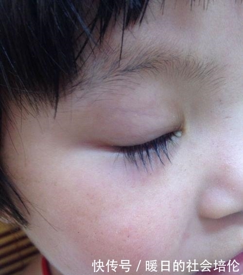 鸡内金|这1物是消积健脾冠军,金牌育嫂带娃半年,长高10公分,发育好