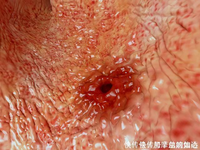 3种水果''伤胃不浅'',你若常吃,胃将''烂''得更快,劝趁早戒掉