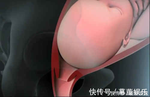 胎儿|产道那么小婴儿是怎么出来的这张图很生动,看完感叹母爱伟大