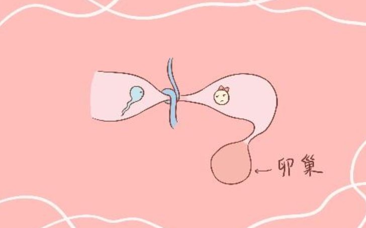 精子|输卵管结扎多年，想好孕还能实现吗？