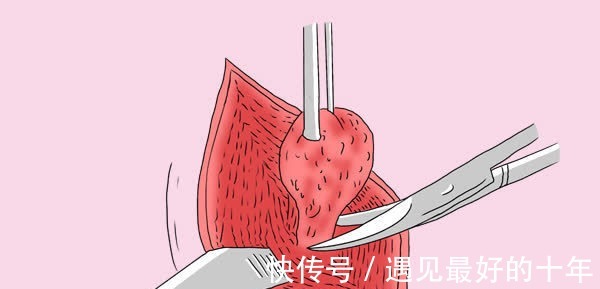 肝病|转氨酶升高,一定是肝病导致的吗?教你3招分辨转氨酶升高的诱因