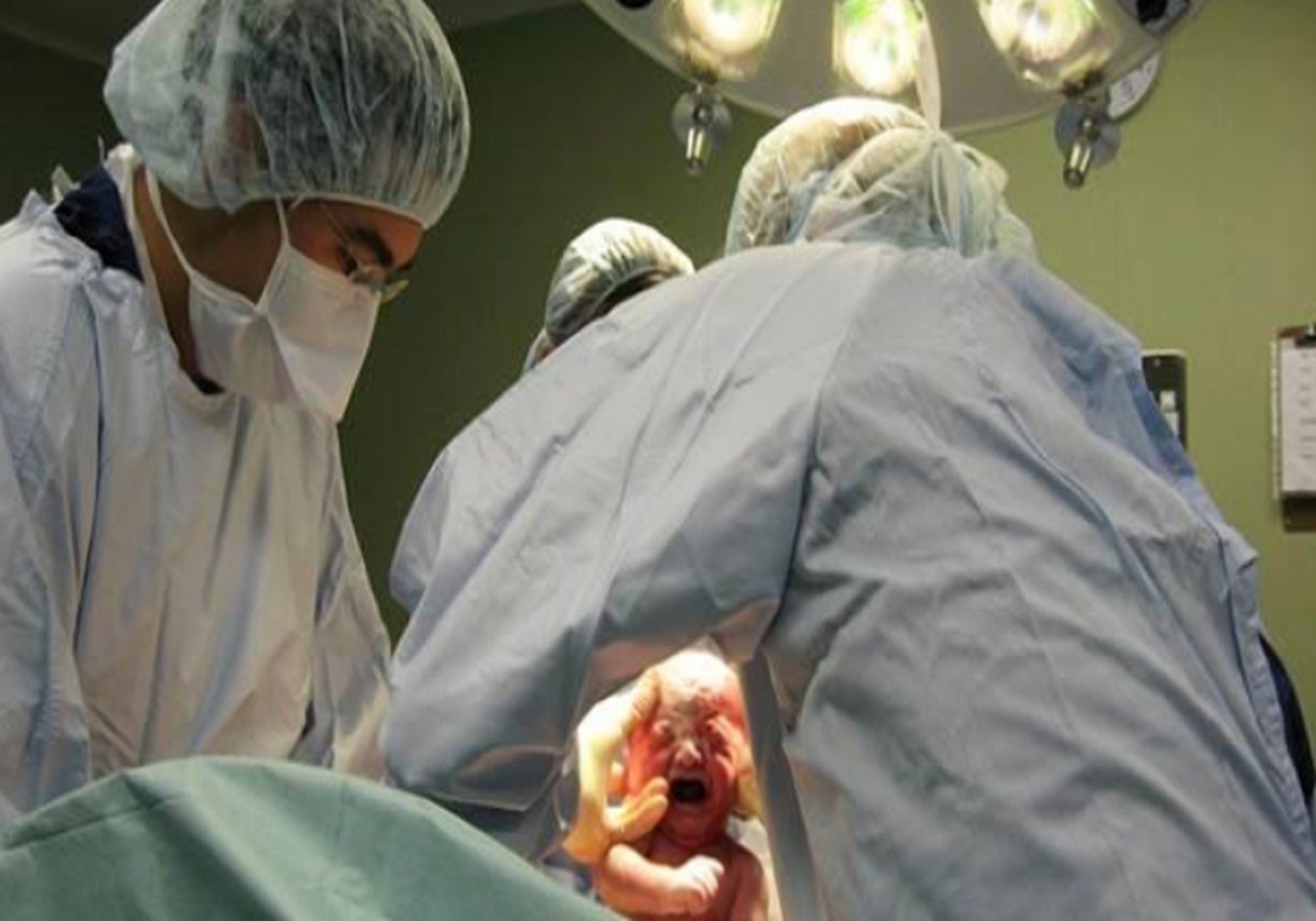 医护人员|顺产生娃是啥体验?过来人:宝宝被一把“拽出来”,再也不想生了