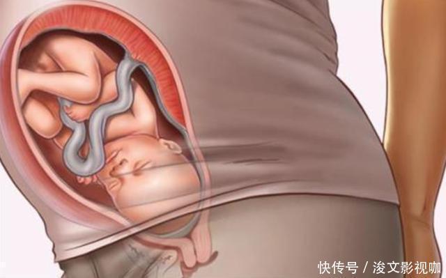 胎儿|孕期做到“4不碰”，有利于保持羊水“清澈”，胎儿住着更干净