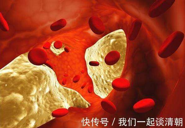 强心脏|此物是三高的“死对头”,化血栓,强心脏,很多人当垃圾扔了