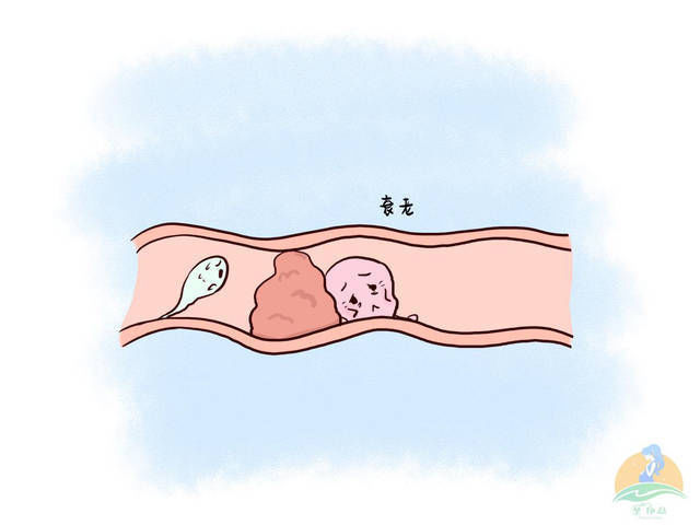 受精卵|若卵子排出后没有遇到精子,会去向何方别不好意思了解