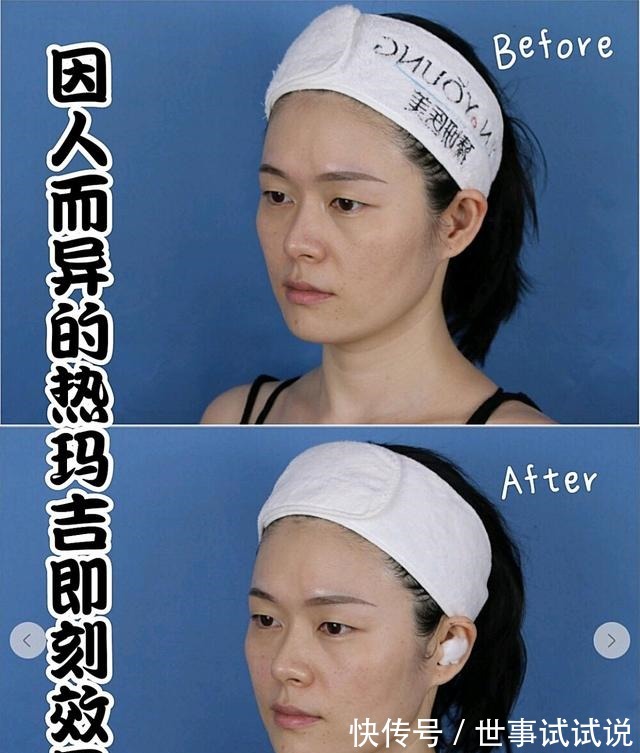 效果 为什么我做了热玛吉没效果!