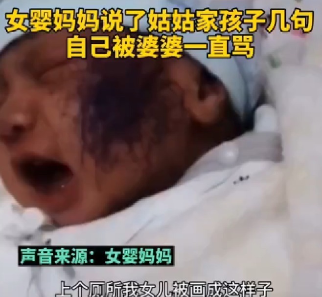 满月女婴遭亲戚孩子乱涂乱画,脸上全是墨水,亲戚:和孩子较啥劲