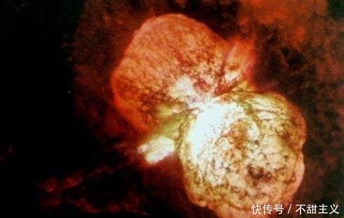 距地球近8000光年，仍能施加毁灭性影响，这个星球太牛了！