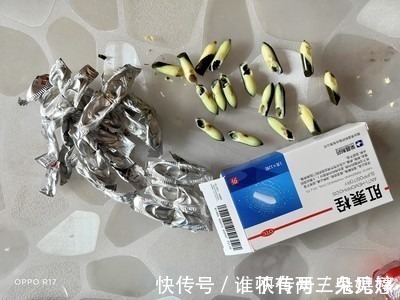 肛周|才知道痔疮缓解这么简单,痔疮用什么药膏擦着效果好?
