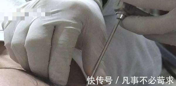 父母|8岁男孩耳朵疼痛难忍,父母带孩子去检查,取出的东西让爸妈崩溃